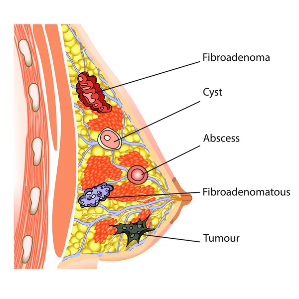 Anatomia kobiecych piersi — Wektor stockowy