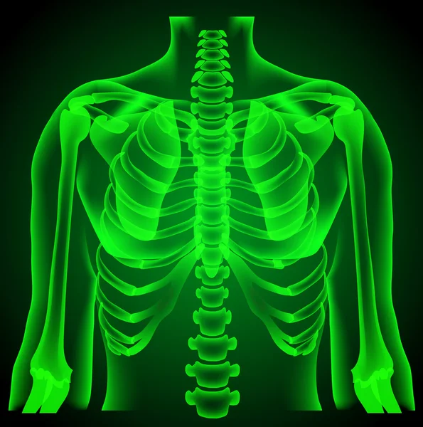 Surgeon radiologist medical examaning lung torso  x-ray — Stock Vector