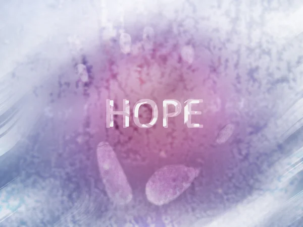 El izi camına izlemek umut