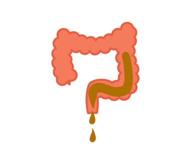 Beyaz arka planda bağırsaklar. İshal. Vektör illüstrasyonu.