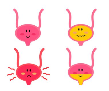 Beyaz arka planda mesane. Sistit. Vektör illüstrasyonu.