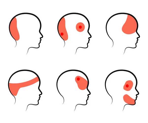 Soorten Hoofdpijn Een Witte Achtergrond Silhouet Vectorillustratie — Stockvector