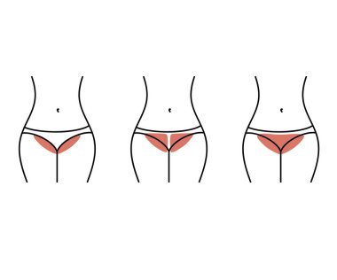 Bikini bölgesi tüy dökücü. Siluet. Vektör illüstrasyonu.