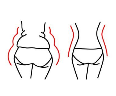 Kadın vücudu kilo vermeden önce ve sonra. Siluet. Vektör illüstrasyonu.
