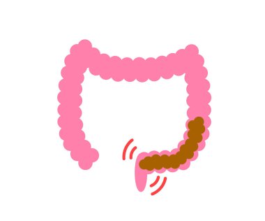 Large intestine on a white background. Constipation. Vector illustration.