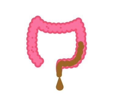 Beyaz arka planda kalın bağırsak. İshal. Vektör illüstrasyonu.