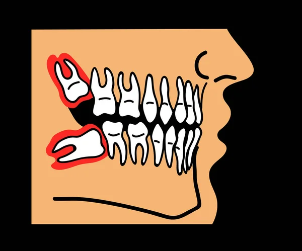 Σοφά Δόντια Στο Στόμα Γελοιογραφία Εικονογράφηση Διανύσματος — Διανυσματικό Αρχείο