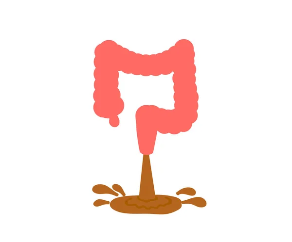 Intestino Grueso Sobre Fondo Blanco Diarrea Ilustración Vectorial — Vector de stock