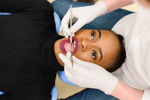 Bela afro-americano étnico preto fêmea abertura boca enquanto dentista em luvas de látex branco verificar condição de seus dentes — Fotografia de Stock