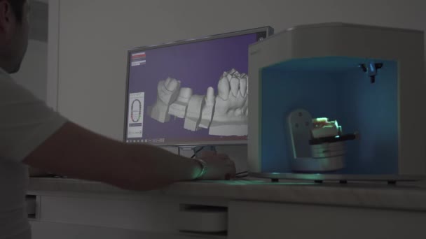 3D Dental Digital Modeling restauratie. Tandartsen high-tech apparatuur op het werk — Stockvideo