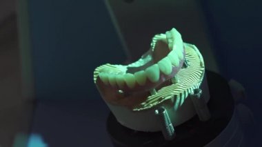 Diş Protez restorasyon. Denturist yüksek teknoloji dijital tarama cihazı ile heykel plastik takma diş için 3B modeli yapma