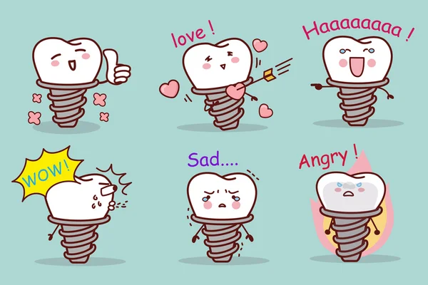 Desenho animado conjunto de emoção implante dentário —  Vetores de Stock