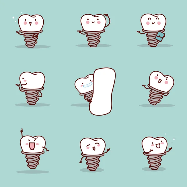 Implante dentário introduzir algo conjunto —  Vetores de Stock