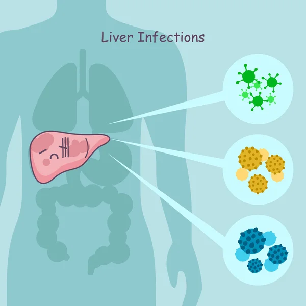 Lindo dibujos animados infecciones hepáticas — Vector de stock