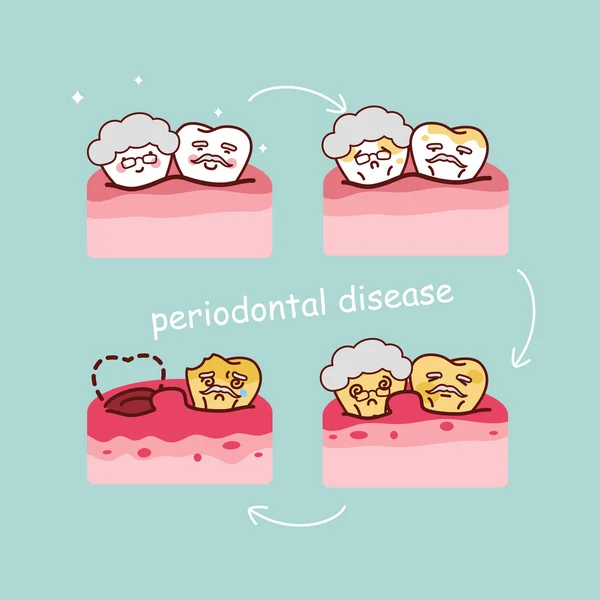 Dente idoso com doença periodontal —  Vetores de Stock