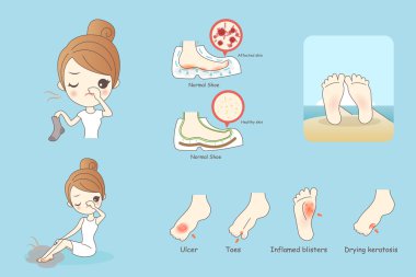 cartoon woman with athlete foot clipart