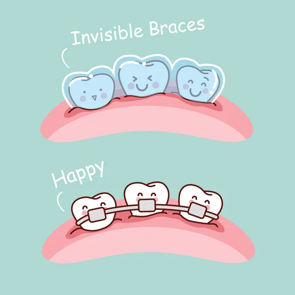 görünmez diş telleri ile karikatür diş