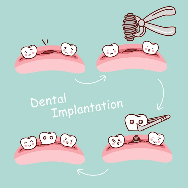 Desenho animado dente conceito de implantação dentária —  Vetores de Stock