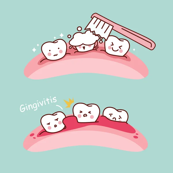 Мультяшная зубная щетка и гингивит — стоковое фото