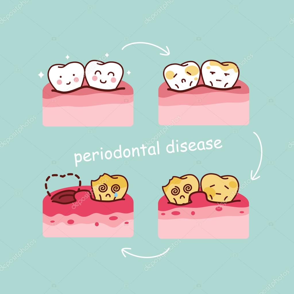 Penyakit Gusi- Global Estetik Dental Care