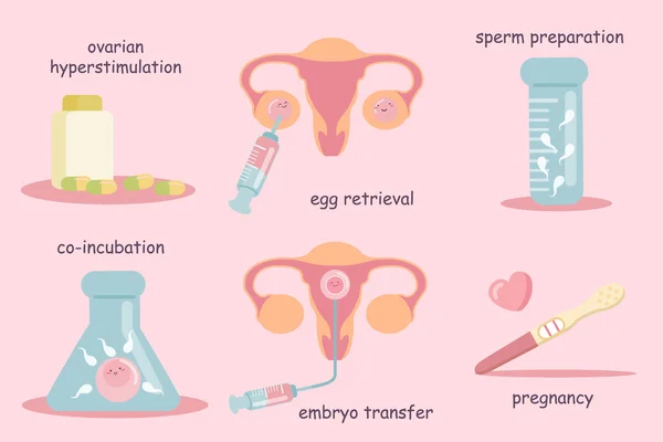 IVF relacionar conceito — Vetor de Stock