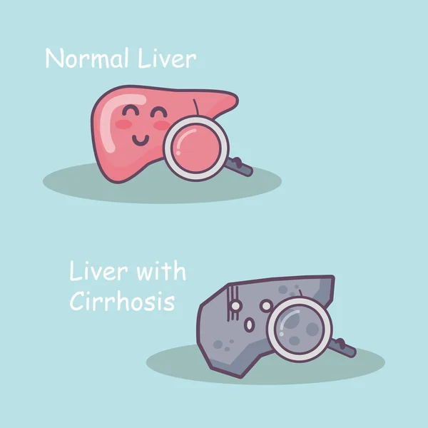 Salud hígado vs cirrosis hígado — Archivo Imágenes Vectoriales