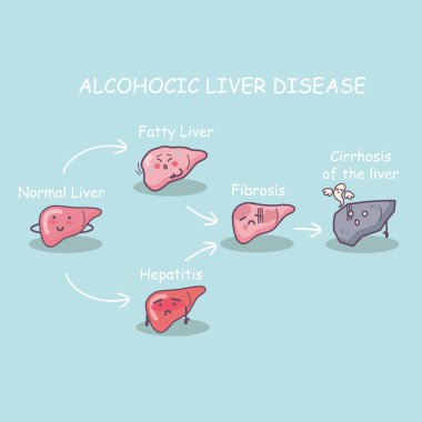 Health liver vs cirrhosis liver clipart