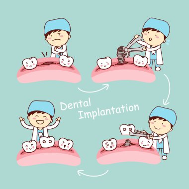 karikatür diş diş implantasyon kavramı