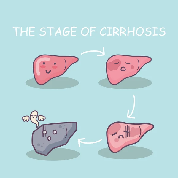 Salud hígado vs cirrosis hígado — Archivo Imágenes Vectoriales