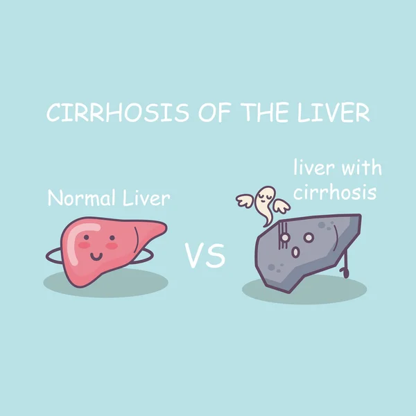 Saúde fígado vs cirrose fígado — Vetor de Stock