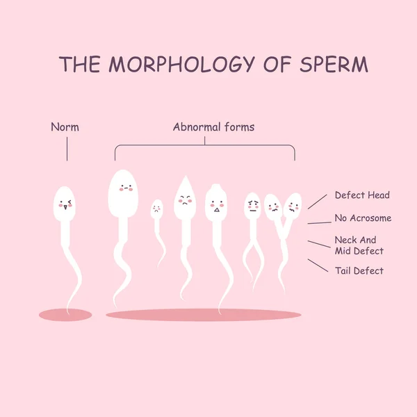 A morfologia do esperma —  Vetores de Stock