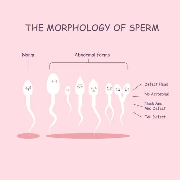 The morphology of the sperm — Stock Vector