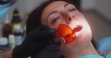 Dişçi hastaların dişlerini tedavi ederken ultraviyole lamba kullanıyor