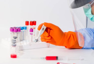 Coronavirus tespiti için laboratuarda kan tüpü var. 