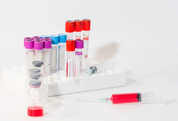 Blutrohr Labor Zum Nachweis Von Coronavirus — Stockfoto