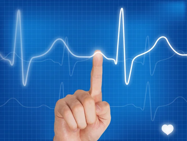 Pointing on a electrocardiogram — Stock Photo, Image