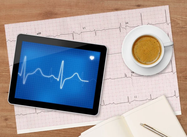 Examen electrocardiográfico en la mesa — Foto de Stock