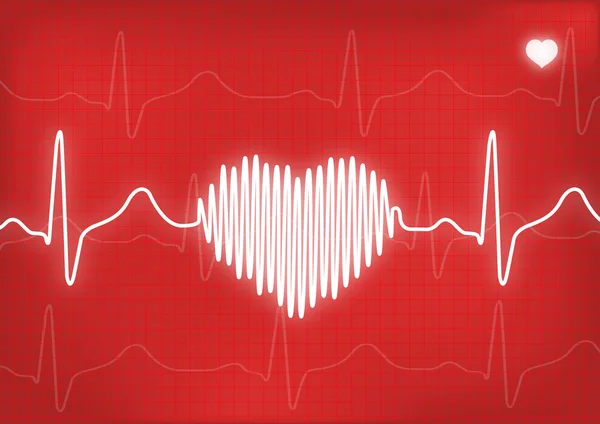 Monitor de ondas EKG — Fotografia de Stock