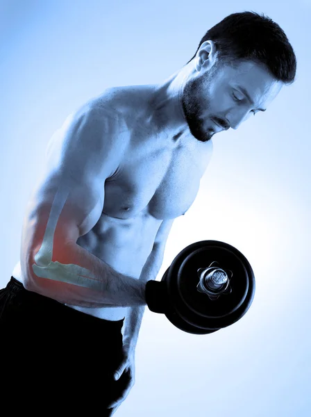 Weightlifting injury on gray — Stock Photo, Image