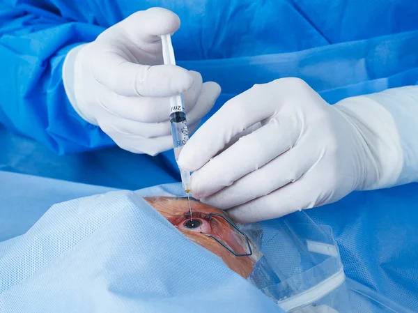 Médico realizando cirugía ocular — Foto de Stock