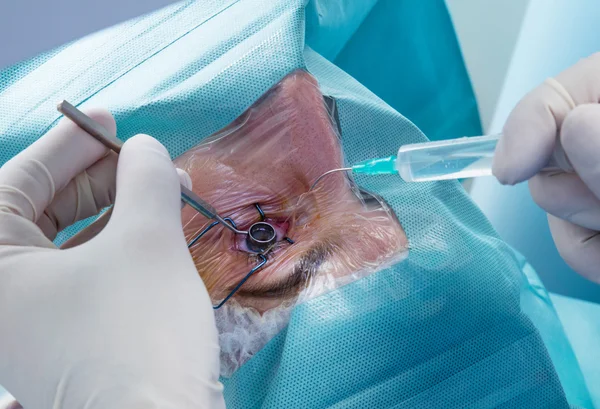 Eye surgery in hospital — Stock Photo, Image