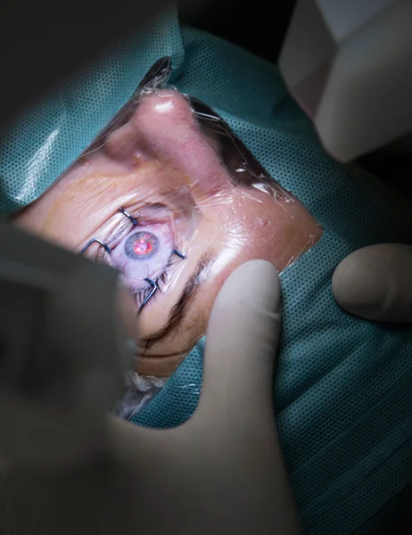 Chirurgie des yeux à l'hôpital — Photo