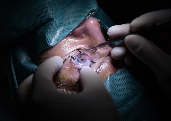 Chirurgie des yeux à l'hôpital — Photo