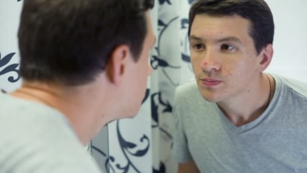 鏡の前でトラブル肌を持つ男 — ストック動画