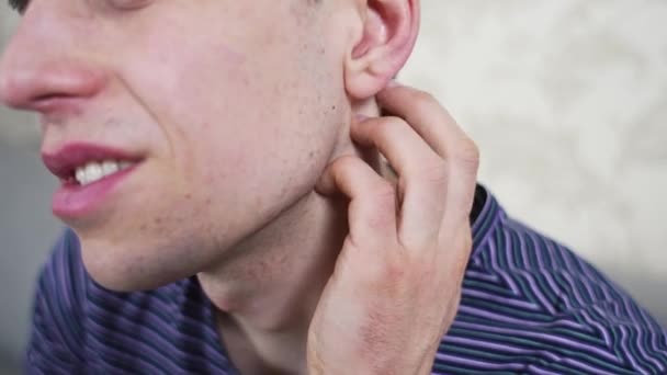 Man scratching itchy reddened neck — Stock Video