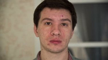 Akne olan adam