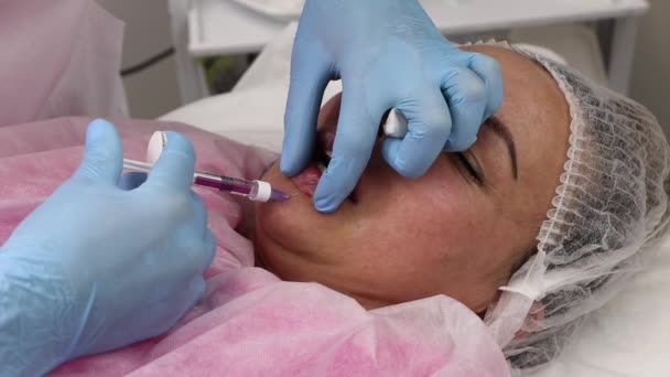 Cosmetologia, aumento delle labbra, iniezioni di bellezza in un salone di bellezza, primo piano. — Video Stock