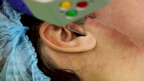 Cosmetology, laser resurfacing, facial cleansing in the beauticians office, in a beauty salon. — Stock videók