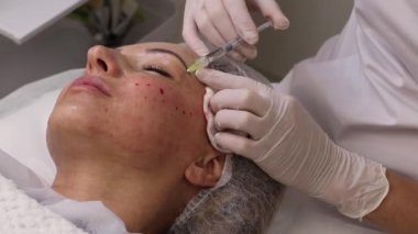 Biyolojik evrim, mezoterapi prosedürü, hiyalüronik asit enjeksiyonları, cilt gelişimi ve gençleştirme, yüz hatlarını düzeltme, güzellik uzmanı ve hasta, yakın çekim.