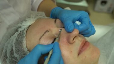 Sivilce ve whiteheads yüzündeki güzellik uzmanı sıkar